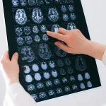 Lire la suite à propos de l’article Comment récupérer après un accident vasculaire cérébral ?