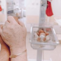 Grands prématurés : une grille d’observation pour repérer tôt les difficultés du développement